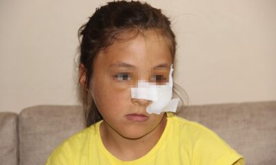 Amcaoğlu küçük kıza demir boruyla dehşeti yaşattı