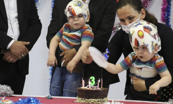 Ameliyatla ayrılan siyam ikizlerine doğum günü sürprizi