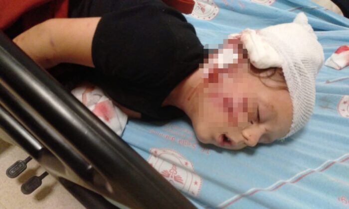 Antalya’da köpeğin saldırısına uğrayan 3,5 yaşındaki çocuk, ölümden döndü