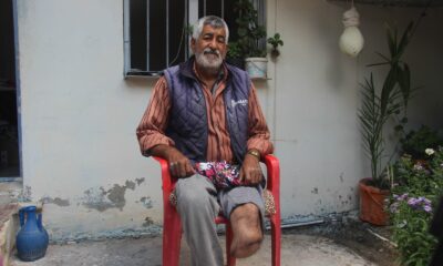 Ayağı kesilen Türk vatandaşına Suriyeli doktordan ücretsiz protez takıldı