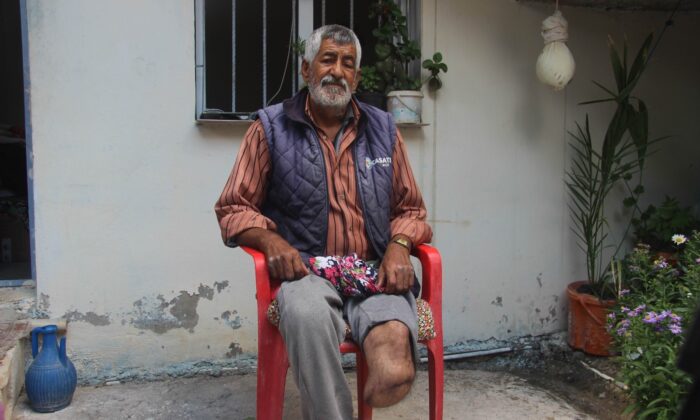 Ayağı kesilen Türk vatandaşına Suriyeli doktordan ücretsiz protez takıldı