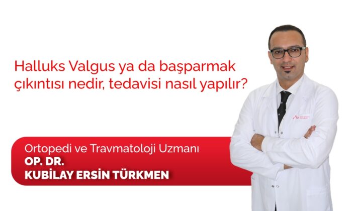 Başparmak çıkıntısı ve tedavisi