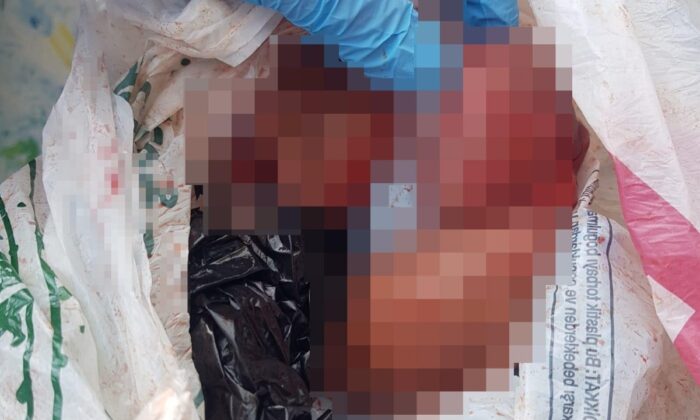 Cadde ortasında düşük yapan kadın, bebeğini çöpe attı