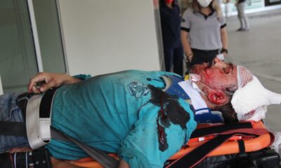 Çatı çöktü, tadilat yapan vatandaş yaralandı