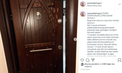 Eşinden şiddet gördüğünü iddia eden Derya Yavuzyiğit: