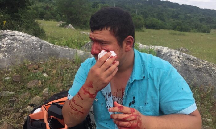 Feci şekilde darp edilen İHA Muhabiri Uslu: “Yere yattım fakat tekmelemeye devam ettiler”