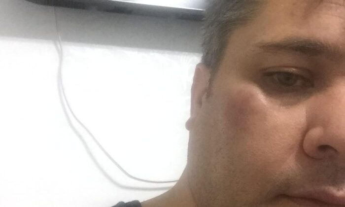 Haber takibindeki İHA muhabirine çirkin saldırı