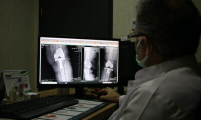 İleri aşamalı eklem kireçlenmeleri ciddi sorunlara sebebiyet veriyor