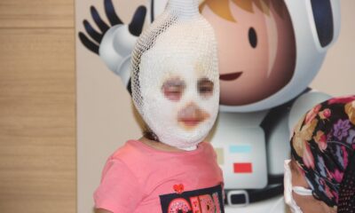 Kaynar suyu üzerine döken çocuk feci şekilde yandı