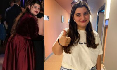 Obezite ameliyatı olmaya Almanya’dan geldi, 10 günde 10 kilo verdi