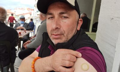 (ÖZEL) Covid19 aşısından sonra dikkat çeken olay