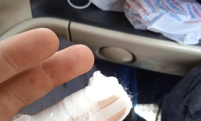 Parmağındaki 3 santimetrelik vidayla hastaneye koştu