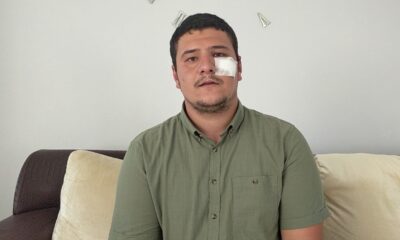 Saldırıya uğrayan İHA muhabiri Akşener’i yalanladı