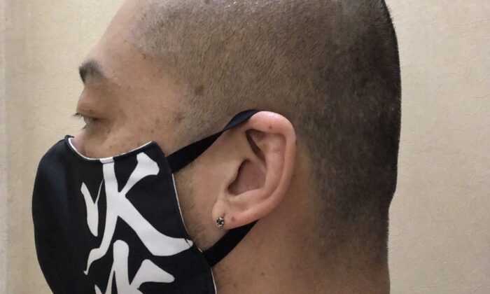 Sattığı yemekten saç çıkan Japon kendini cezalandırdı