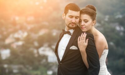 Uzmanlara göre düğünden 1 ay önce saç ekimi yaptırılabilir