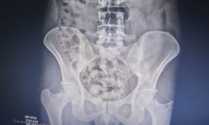 Van polisi ve MİT’ten zehir tacirlerine ortak operasyon