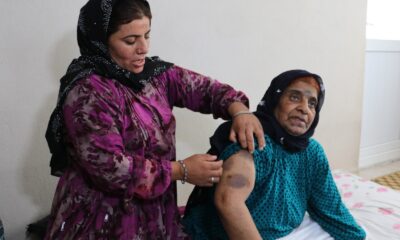 Yaşlı kadına yoğun bakımda darp iddiası