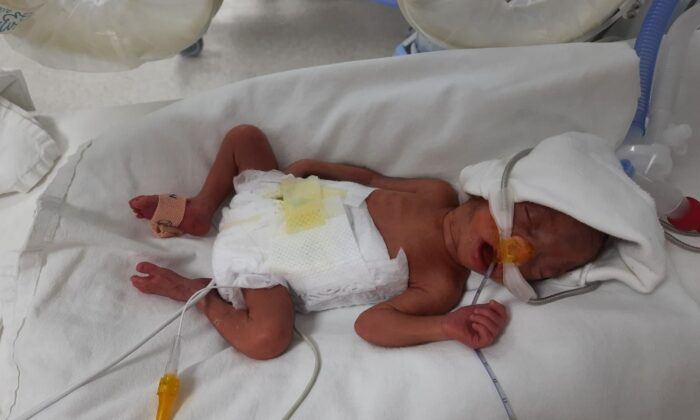 850 gram doğan Müge bebek, hayata tutunmayı başardı