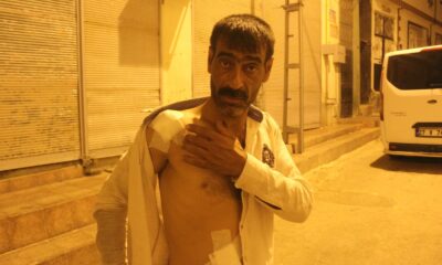 Damda çay içerken kavgada ateşlenen saçmaların hedefi oldu