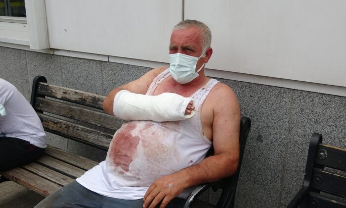 Kurban keserken arkadaş kurbanı oldu