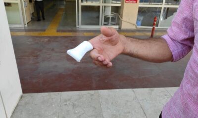 Şanlıurfa’da acemi kasaplar hastanelik oldu