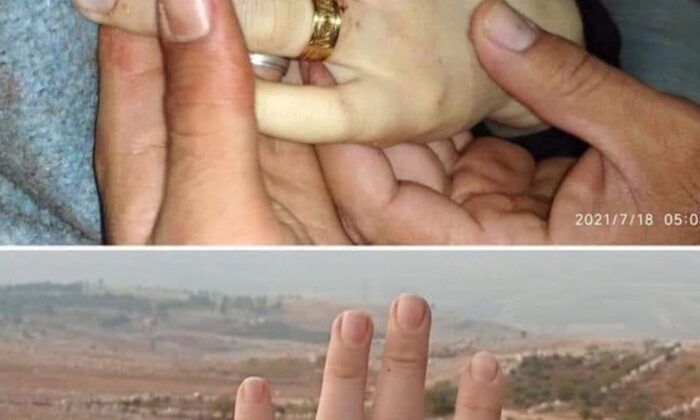 Suriyeli Meryem, düğününden 6 gün sonra rejim saldırılarında hayatını kaybetti