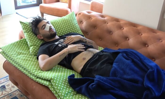 Taşlı sopalı kavgada burnu kırılan gencin babası adalet istedi