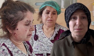 Eşinin evini tüfekle bastı, dehşet saçtı! Cani kocanın yaptıkları kan dondurdu: ‘Ayağına poşet eriterek…’