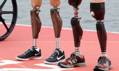 Özgürlüğünüzü Yeniden Kazanın: Protez Bacaklar