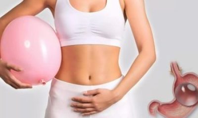 Yutulabilir Mide Balonu Fiyatı 2024