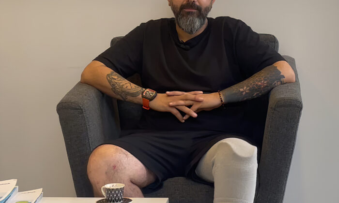 Protez Bacak Nedir? Hayatın Her Adımını Yeniden Atmak