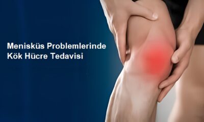 Kök Hücre Tedavisi Menisküs Yırtıklarını Ameliyatsız Tedavi Ediyor!